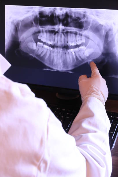 Best Emergency Treatment for Oral Infections in Jamesburg, NJ