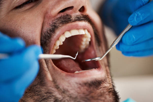 Best Emergency Root Canal Therapy in Jamesburg, NJ