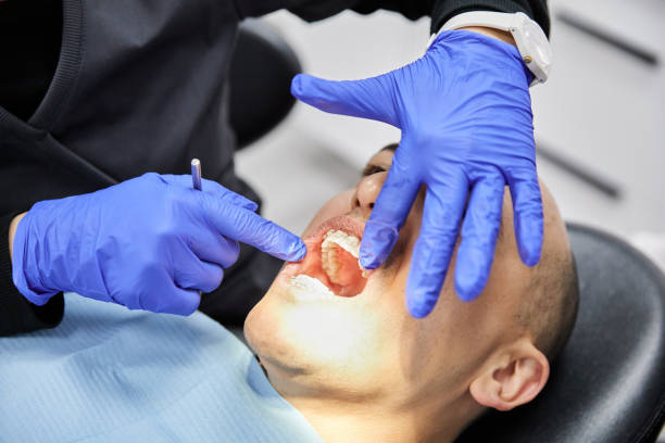 Best Broken or Chipped Tooth Repair in Jamesburg, NJ
